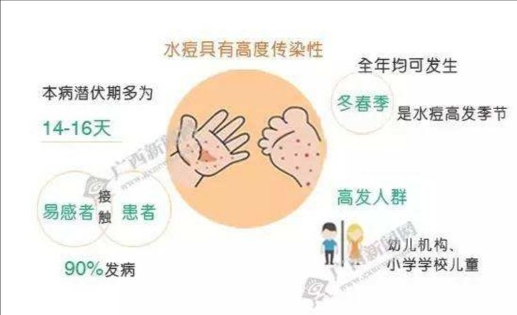 秋冬季传染病的预防————水痘的预防知识宣传